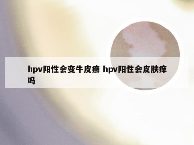 hpv阳性会变牛皮癣 hpv阳性会皮肤痒吗