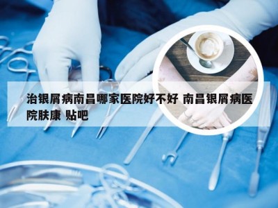 治银屑病南昌哪家医院好不好 南昌银屑病医院肤康 贴吧