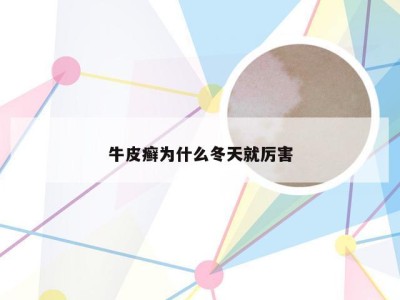 牛皮癣为什么冬天就厉害