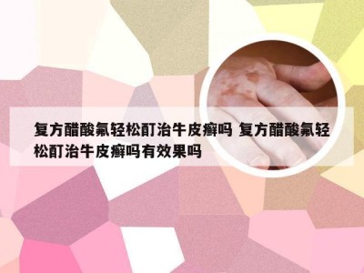 复方醋酸氟轻松酊治牛皮癣吗 复方醋酸氟轻松酊治牛皮癣吗有效果吗
