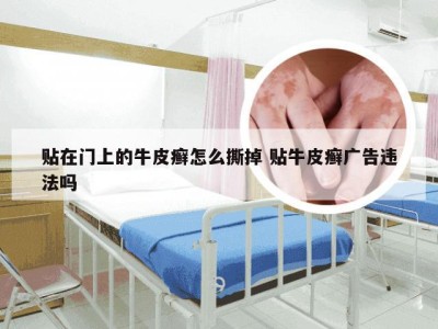 贴在门上的牛皮癣怎么撕掉 贴牛皮癣广告违法吗