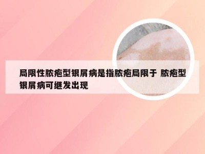 局限性脓疱型银屑病是指脓疱局限于 脓疱型银屑病可继发出现