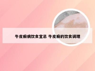 牛皮癣病饮食宜忌 牛皮癣的饮食调理