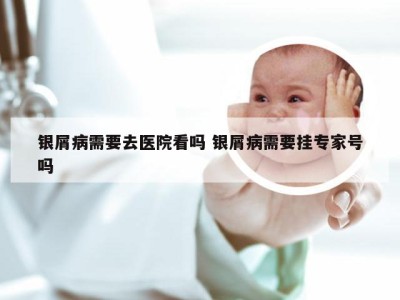银屑病需要去医院看吗 银屑病需要挂专家号吗