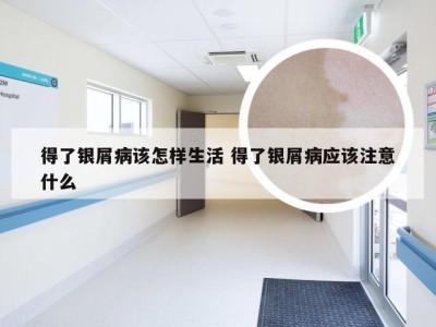 得了银屑病该怎样生活 得了银屑病应该注意什么