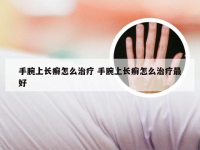 手腕上长癣怎么治疗 手腕上长癣怎么治疗最好