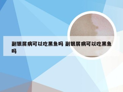 副银屑病可以吃黑鱼吗 副银屑病可以吃黑鱼吗