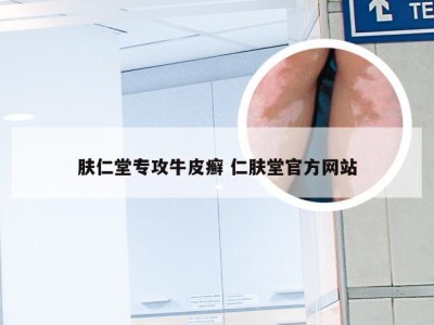 肤仁堂专攻牛皮癣 仁肤堂官方网站