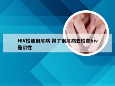 HIV检测银屑病 得了银屑病去检查hiv是阴性