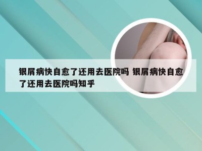 银屑病快自愈了还用去医院吗 银屑病快自愈了还用去医院吗知乎