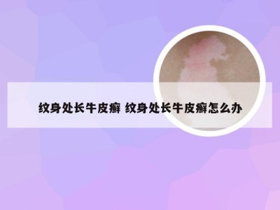 纹身处长牛皮癣 纹身处长牛皮癣怎么办