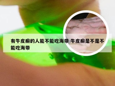 有牛皮癣的人能不能吃海带 牛皮癣是不是不能吃海带