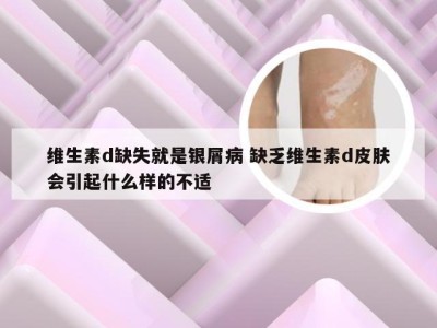 维生素d缺失就是银屑病 缺乏维生素d皮肤会引起什么样的不适
