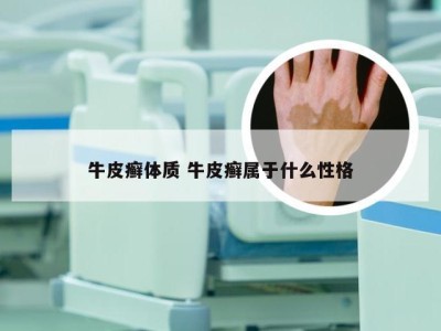 牛皮癣体质 牛皮癣属于什么性格
