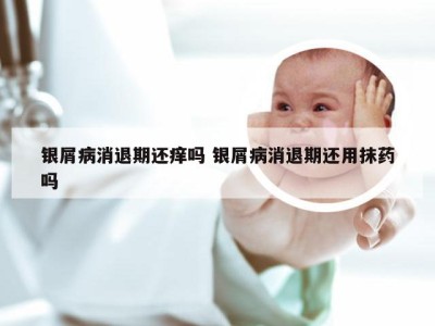 银屑病消退期还痒吗 银屑病消退期还用抹药吗