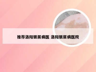 推荐洛阳银屑病医 洛阳银屑病医院