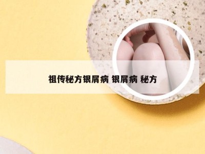 祖传秘方银屑病 银屑病 秘方