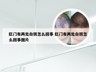 肛门有两处白斑怎么回事 肛门有两处白斑怎么回事图片