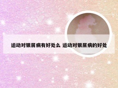 运动对银屑病有好处么 运动对银屑病的好处