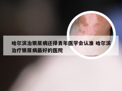 哈尔滨治银屑病还择青年医学会认准 哈尔滨治疗银屑病最好的医院
