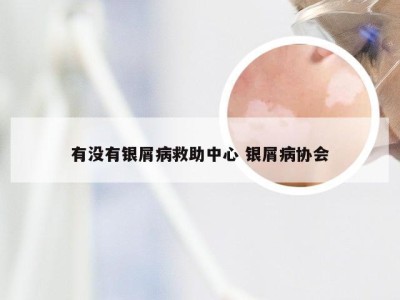 有没有银屑病救助中心 银屑病协会