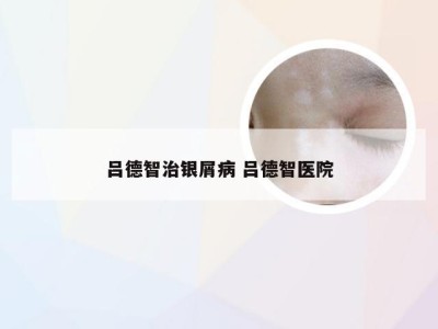 吕德智治银屑病 吕德智医院