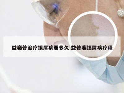 益赛普治疗银屑病要多久 益普赛银屑病疗程