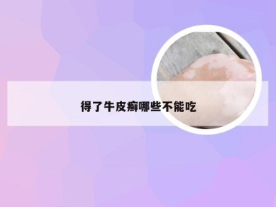 得了牛皮癣哪些不能吃