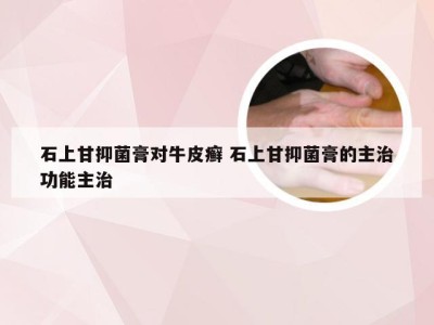 石上甘抑菌膏对牛皮癣 石上甘抑菌膏的主治功能主治