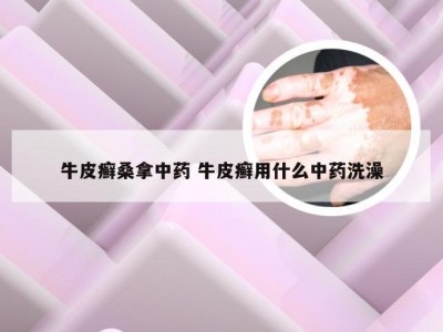 牛皮癣桑拿中药 牛皮癣用什么中药洗澡