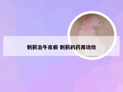 刺蓟治牛皮癣 刺蓟的药用功效
