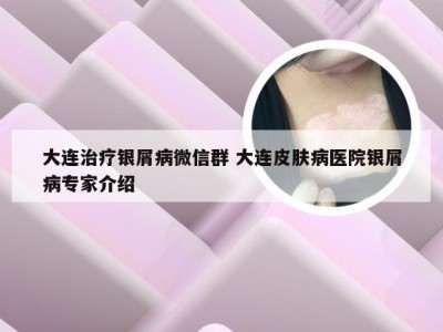 大连治疗银屑病微信群 大连皮肤病医院银屑病专家介绍