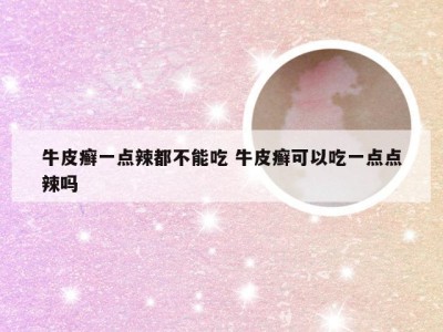 牛皮癣一点辣都不能吃 牛皮癣可以吃一点点辣吗