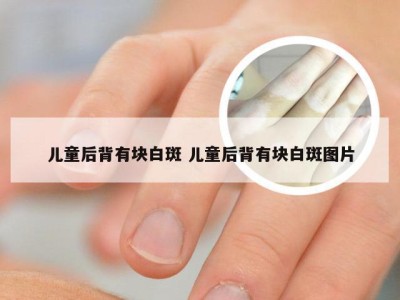 儿童后背有块白斑 儿童后背有块白斑图片