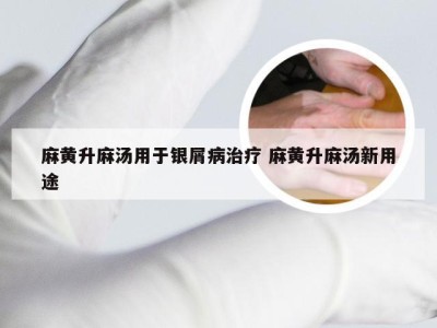 麻黄升麻汤用于银屑病治疗 麻黄升麻汤新用途