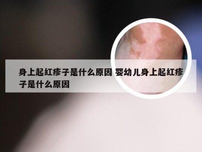 身上起红疹子是什么原因 婴幼儿身上起红疹子是什么原因