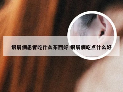 银屑病患者吃什么东西好 银屑病吃点什么好