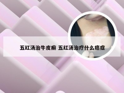 五红汤治牛皮癣 五红汤治疗什么癌症