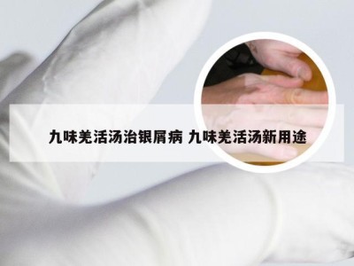 九味羌活汤治银屑病 九味羌活汤新用途