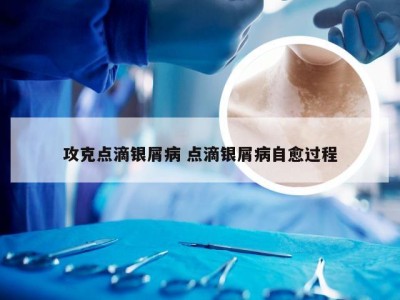 攻克点滴银屑病 点滴银屑病自愈过程