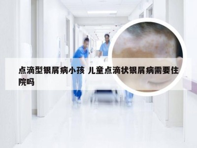 点滴型银屑病小孩 儿童点滴状银屑病需要住院吗