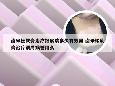 卤米松软膏治疗银屑病多久有效果 卤米松乳膏治疗银屑病管用么