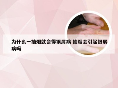 为什么一抽烟就会得银屑病 抽烟会引起银屑病吗