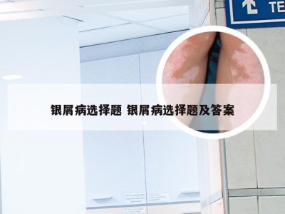 银屑病选择题 银屑病选择题及答案