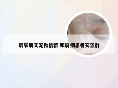 银屑病交流微信群 银屑病患者交流群