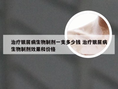 治疗银屑病生物制剂一支多少钱 治疗银屑病生物制剂效果和价格