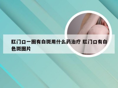 肛门口一圈有白斑用什么药治疗 肛门口有白色斑图片