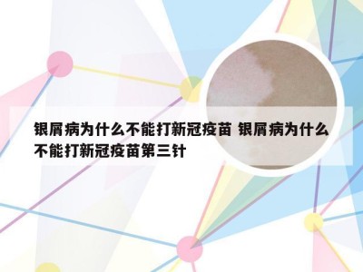 银屑病为什么不能打新冠疫苗 银屑病为什么不能打新冠疫苗第三针