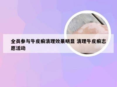 全员参与牛皮癣清理效果明显 清理牛皮癣志愿活动