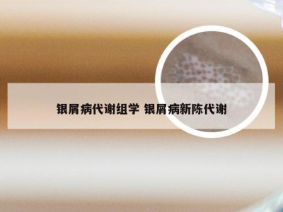 银屑病代谢组学 银屑病新陈代谢